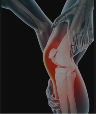 Book an Appointment with Knee Therapy for Knee Treatments